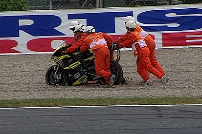 Frattura della clavicola destra per Edwards