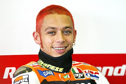 Lockenkopf und mehr: Valentino Rossi im Laufe der Jahre