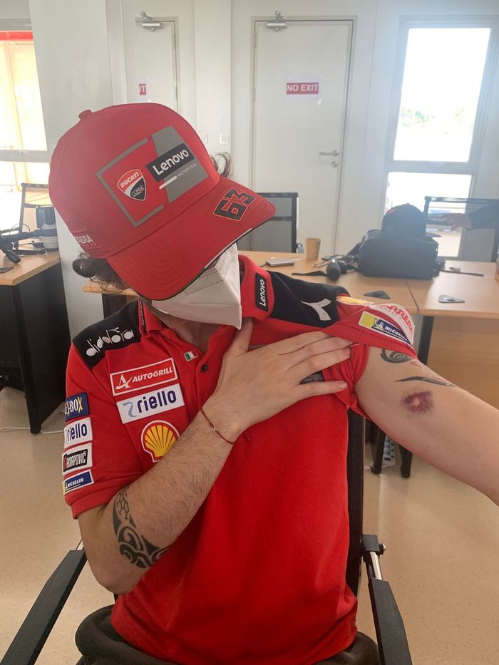 Francesco Bagnaia, Ducati Team, con una herida en el brazo por una piedra