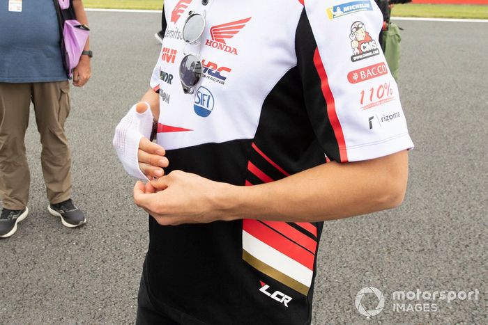 Detalle de la lesión de Takaaki Nakagami, Team LCR Honda