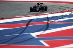 Jenson Button, McLaren MP4-31